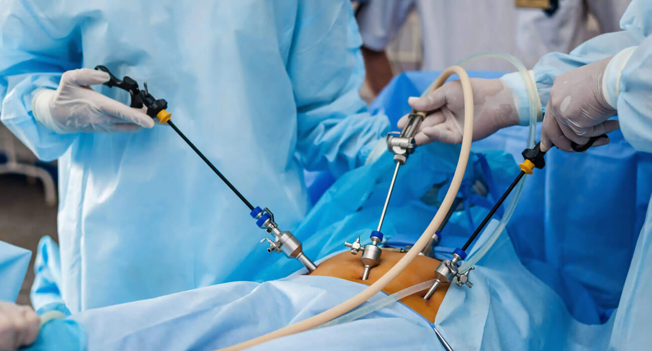 General and Laparoscopic Surgery